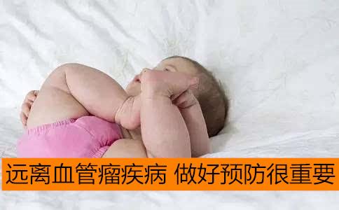 血管瘤患者能否正常上班？全面解读与指导