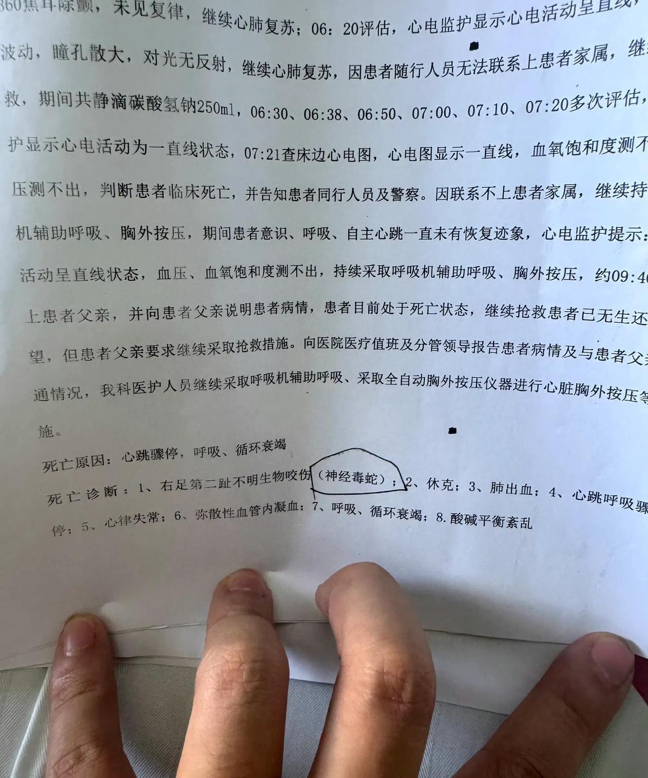 三亚被咬女子确认为神经毒蛇咬伤事件分析
