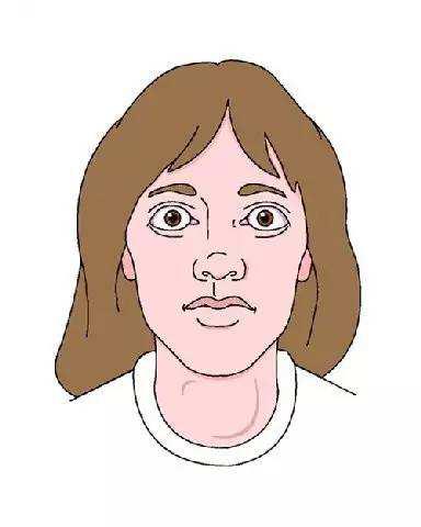 女孩得了甲亢能根治吗？全面解读与希望之光