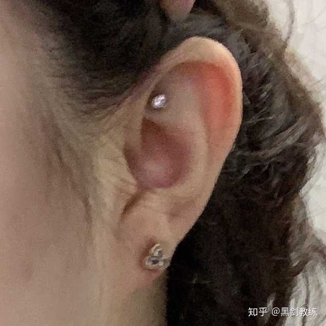 戴着耳钉睡觉有什么危害