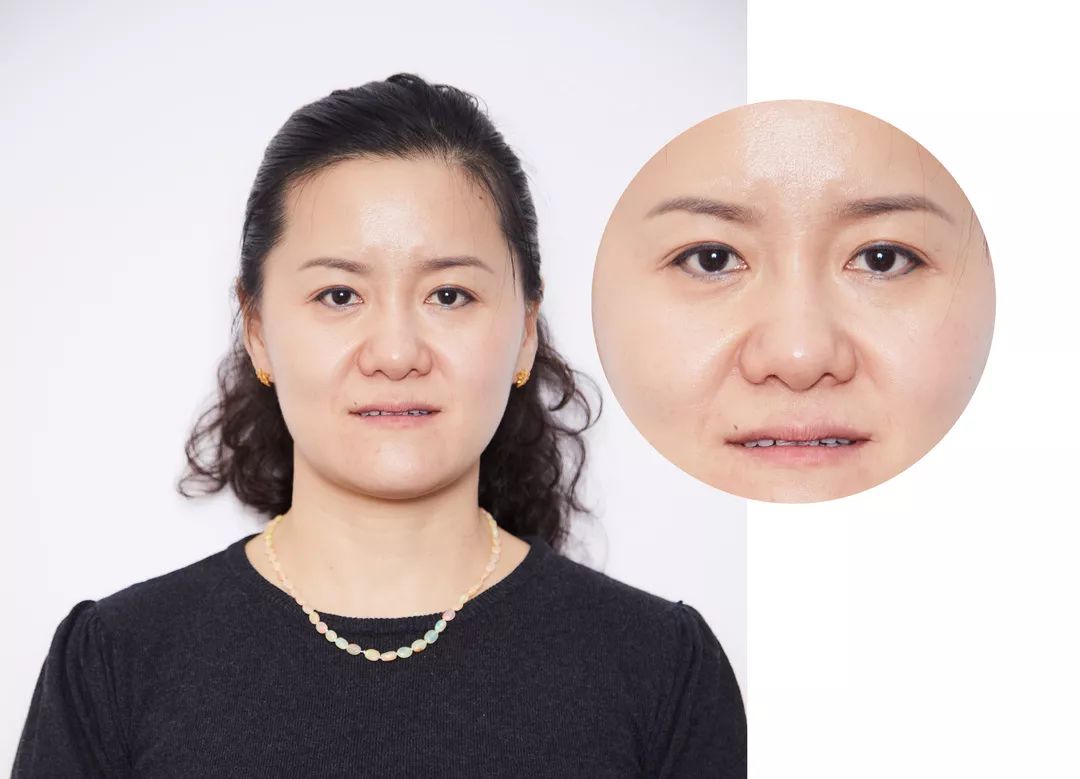 不上镜怎么整容？从内外兼修开始打造完美自己