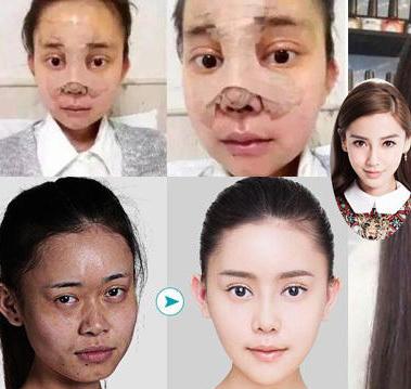 不上镜怎么整容？从内外兼修开始打造完美自己