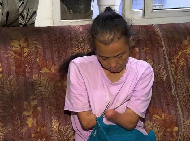 逆境中的璀璨，00后无手女子顺利产女的励志故事