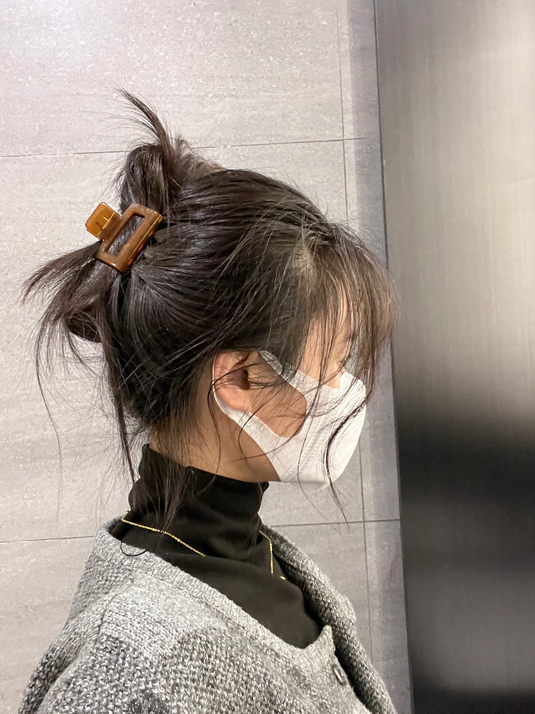 戴鲨鱼夹摔倒扎破头