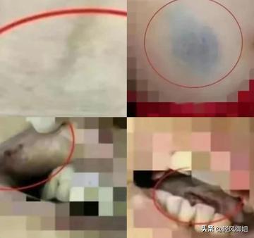 被咬身亡女子家属回应为何不尸检，深度解析事件背后的真相与情感